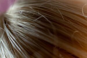 Postpartum Hair Loss: Understanding and Healing Your Strands