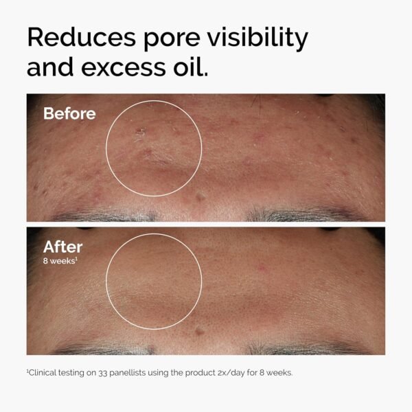 The Ordinary Niacinamide 10% + Zinc 1%, Smoothing ... - Image 3